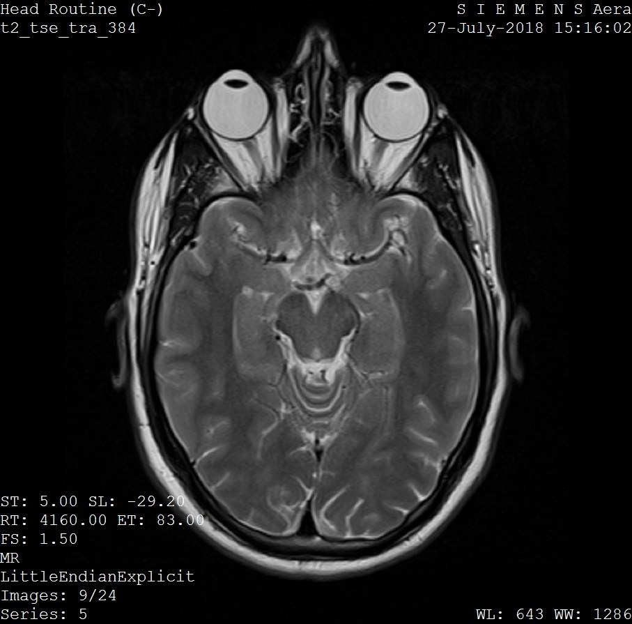 Illustrative single-frame MRI head scan for general illustration purposes