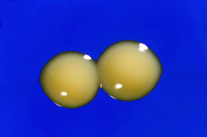 Close-up photograph of Mycobacterium colonies grown on agar (image metadata: Mycobacterium cosmeticum close-up)
