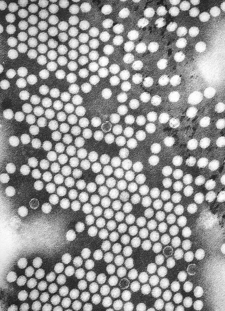 Electron micrograph of the poliovirus (illustrative)