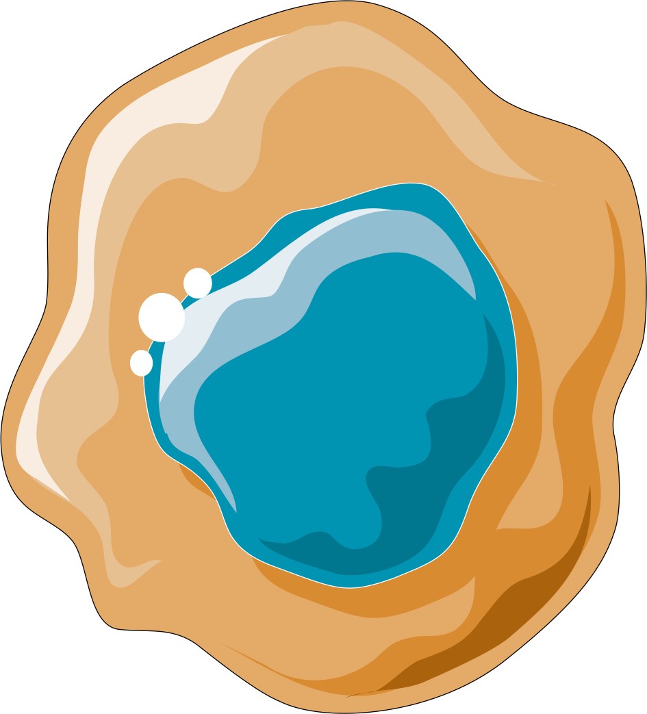 Illustrative image of cancer cells (file: Cancers - Cells 8 -- Smart-Servier.png)