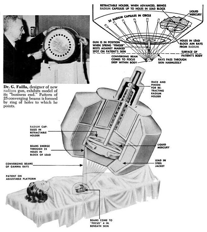 Historic external-beam radiotherapy machine (radium teletherapy), 1951 — illustrative image for radiotherapy in breast cancer.