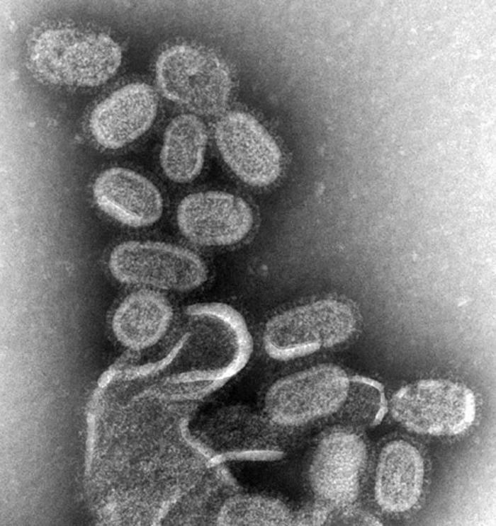 Negative-stain transmission electron micrograph of influenza virions (illustrative image)