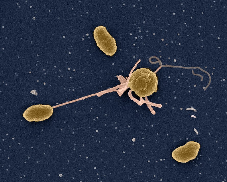 Scanning electron microscope image of Vibrio cells (a close relative of Vibrio cholerae)
