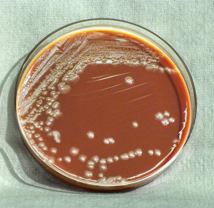 Photograph of Yersinia pestis bacterial colonies grown on chocolate agar (descriptive image of the plague bacillus).